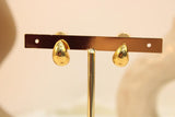 Arete de prensa